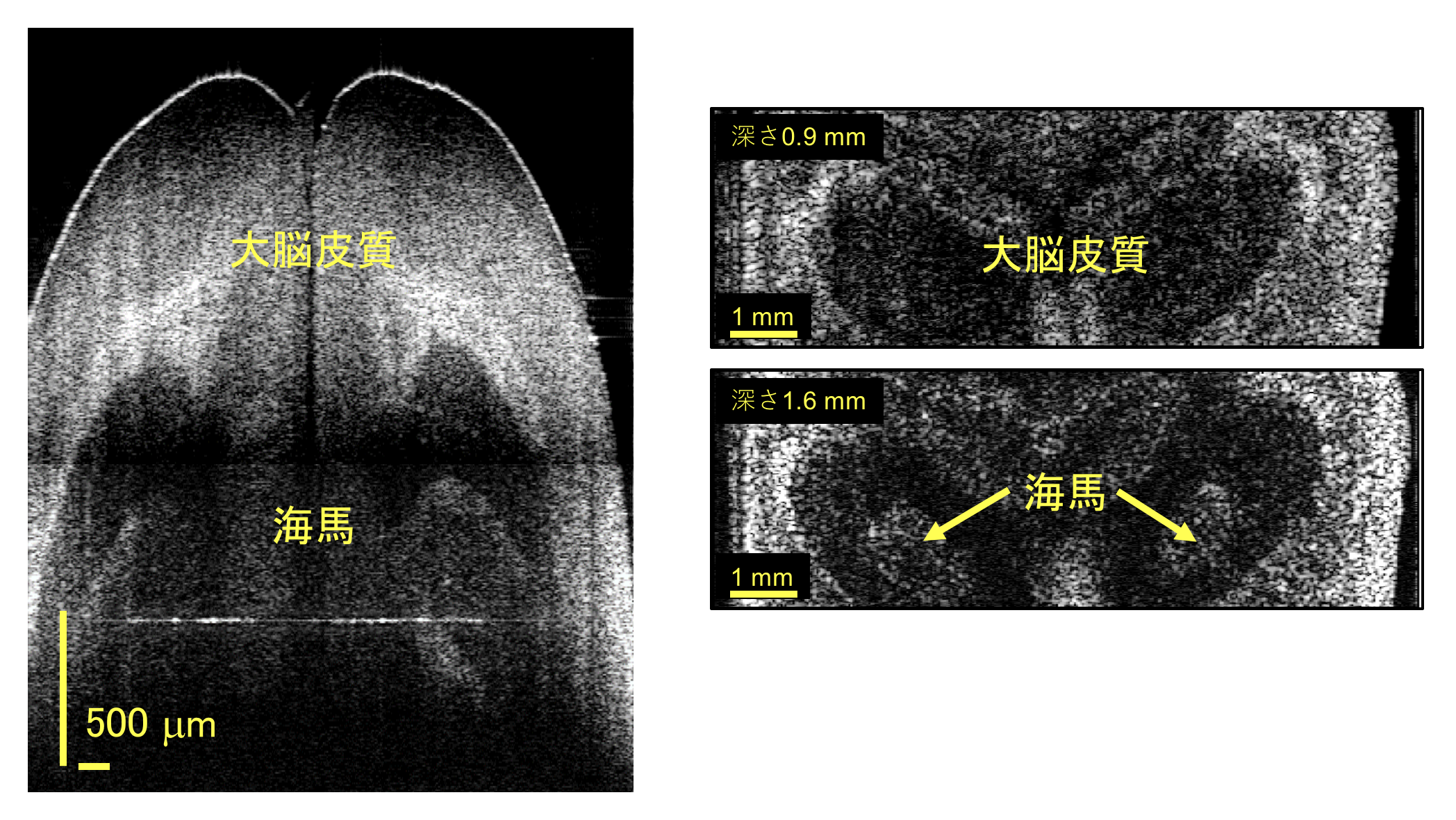 Success of non-destructive deep imaging of mouse brain using 1.7 um OCT/OCM