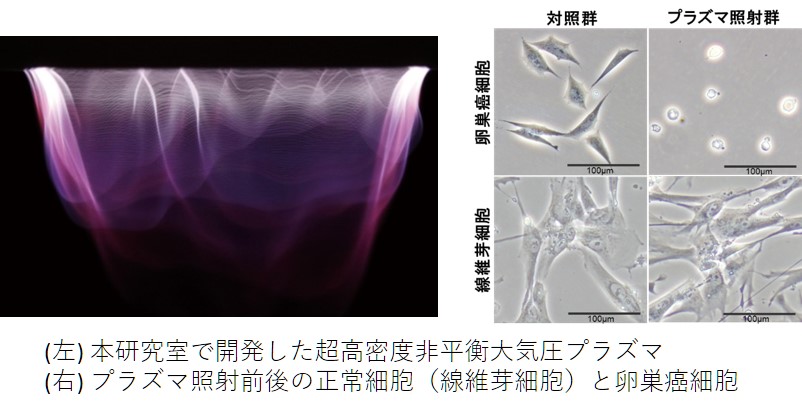 （左）本研究室で開発した超高密度非平衡大気圧プラズマ／（右）プラズマ照射前後の正常細胞（線維芽細胞）と卵巣癌細胞